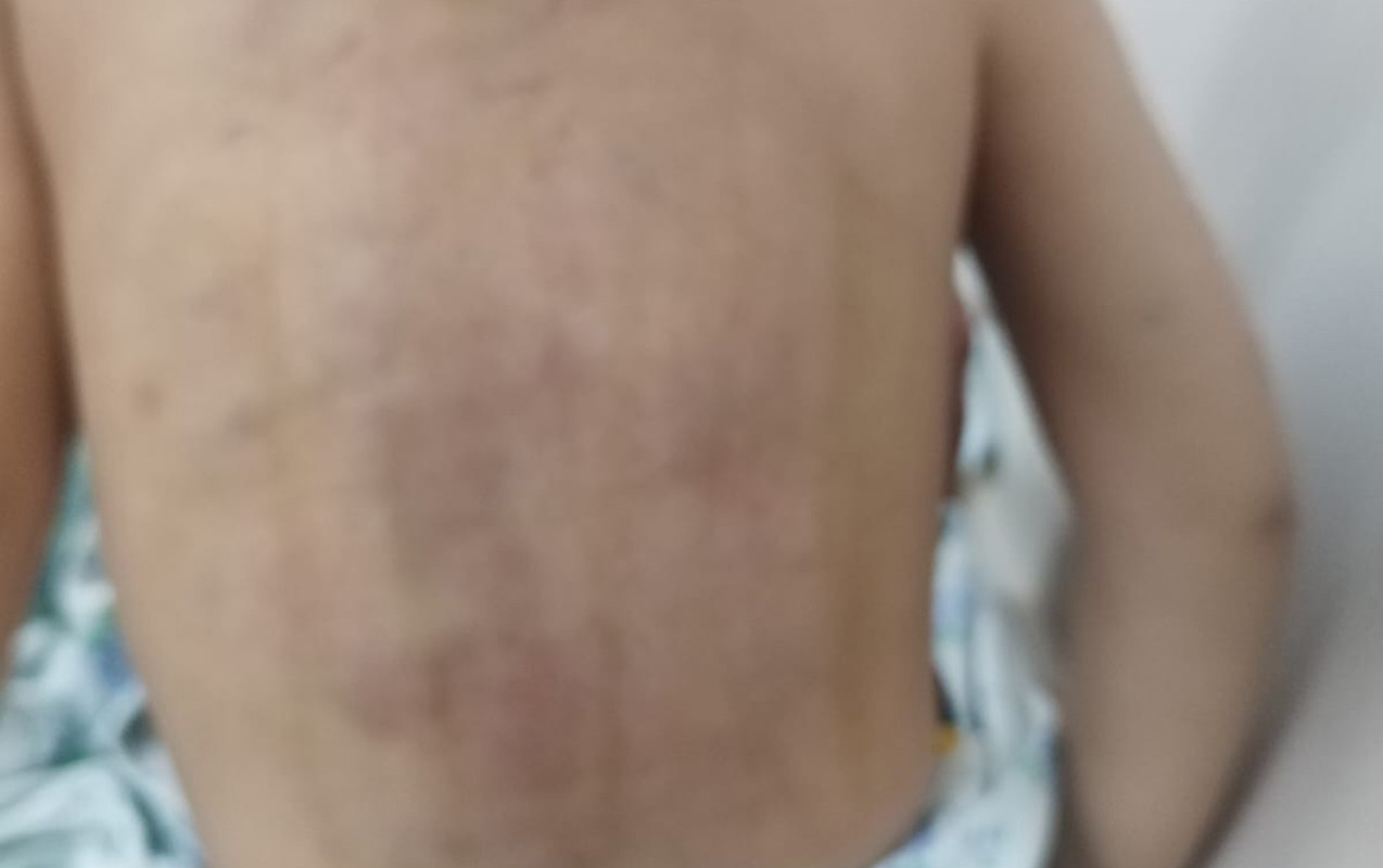 Lənkəranda 3 yaşlı uşaq fiziki zorakılığa məruz qalıb? - Foto