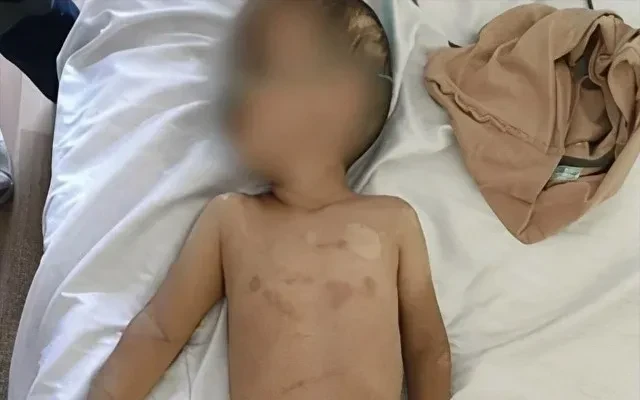 Lənkəranda 3 yaşlı uşağa zorakılıq edən ögey ata SAXLANILDI
